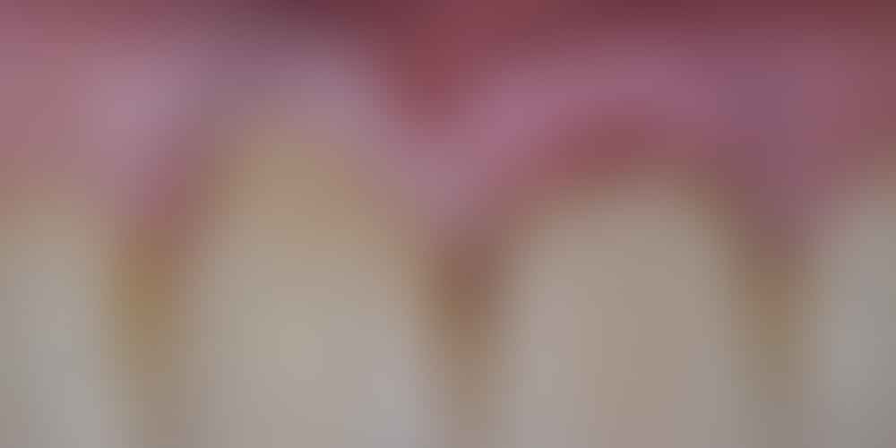What should I do if the local anesthesia doesn't work during a dental procedure?
