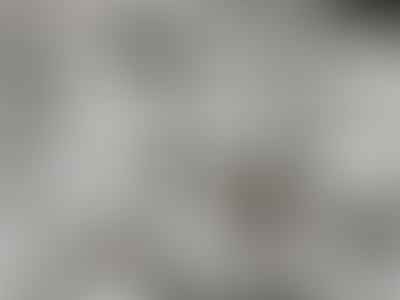 Affordable Dentist Near Me - Grand Prairie