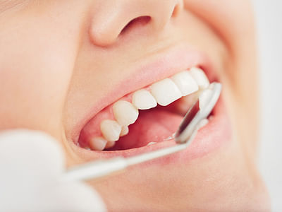 Ranches Family Dental